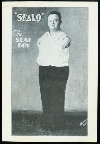 Sealo, The Seal Boy